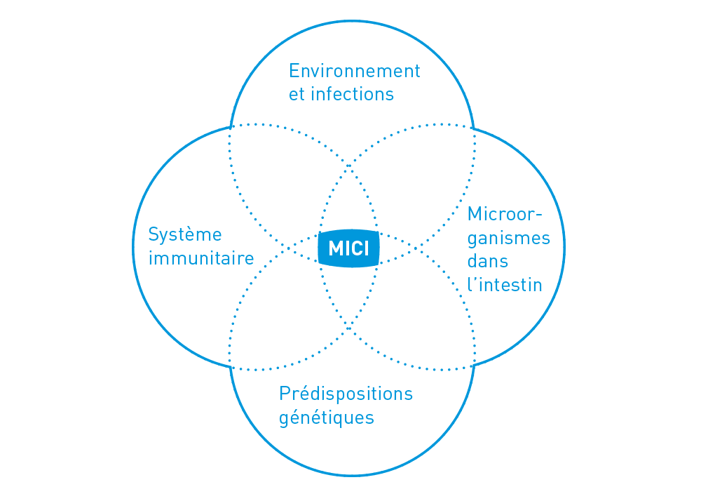 Facteurs de risque des maladies inflammatoires chroniques de lâintestin (MICI)