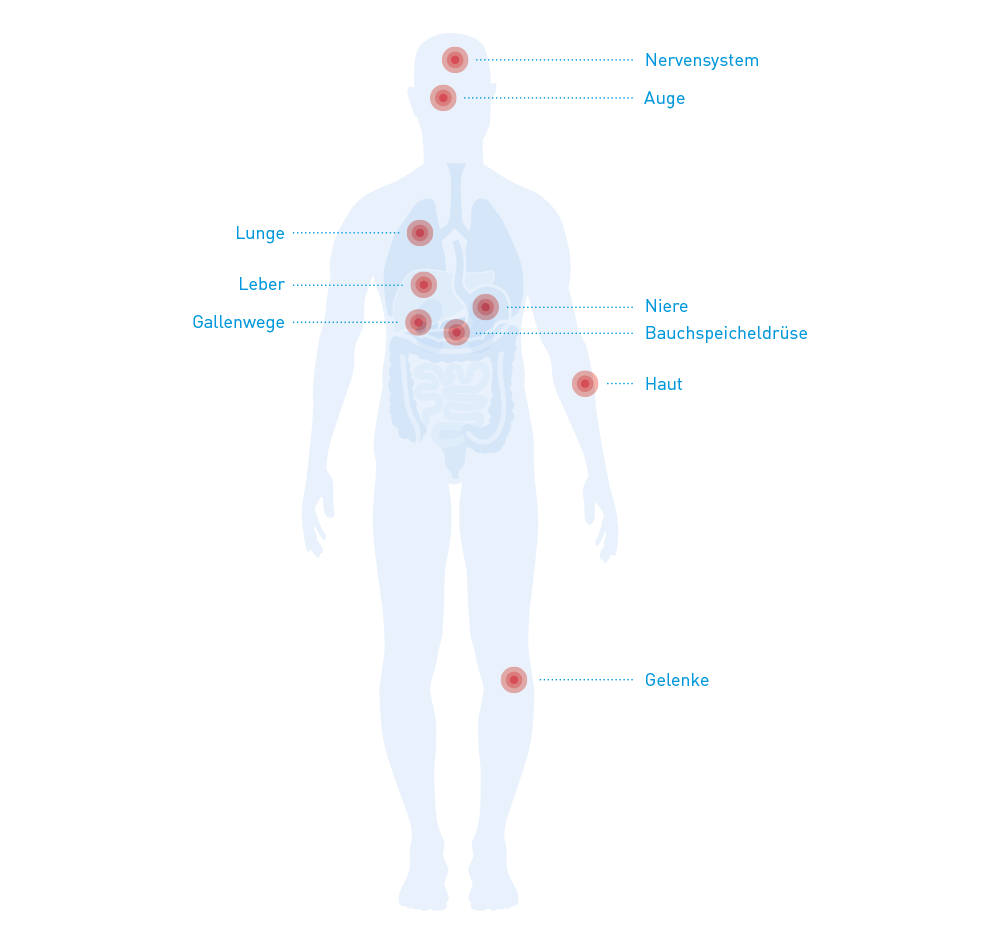 Betroffene Organe und Organsysteme