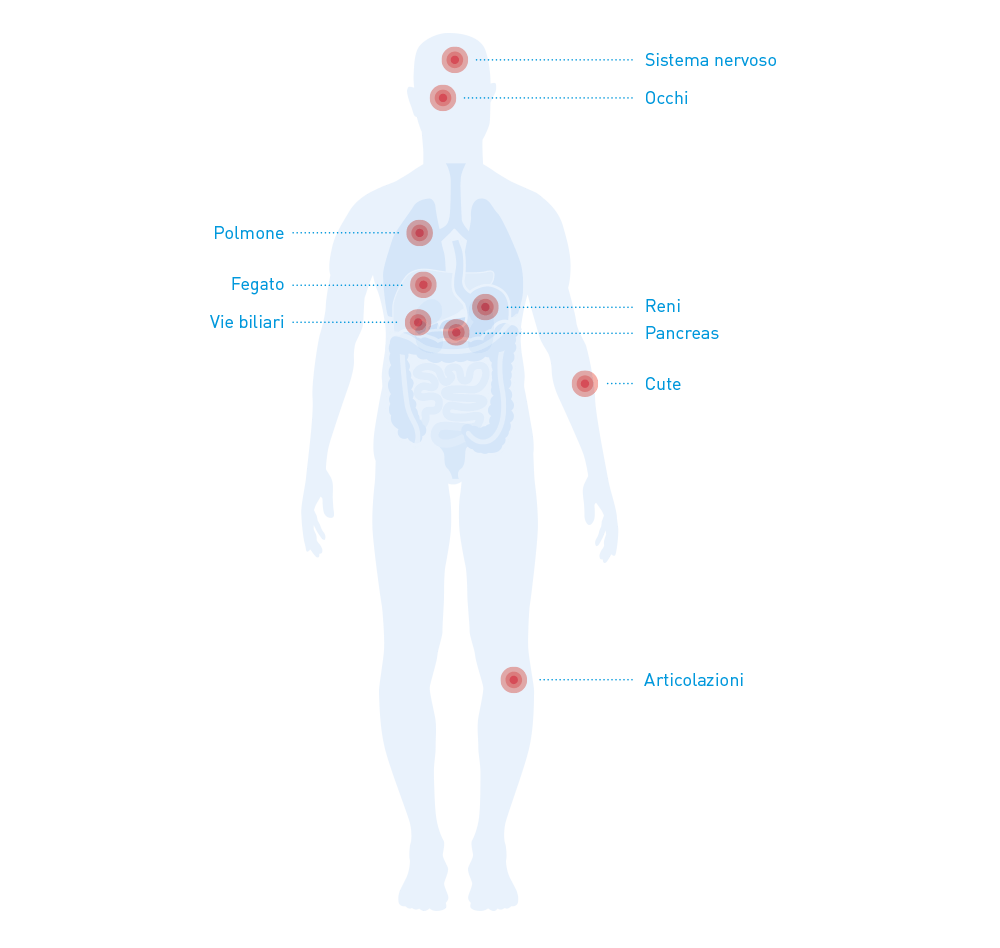 Organi e sistemi d'organo interessati